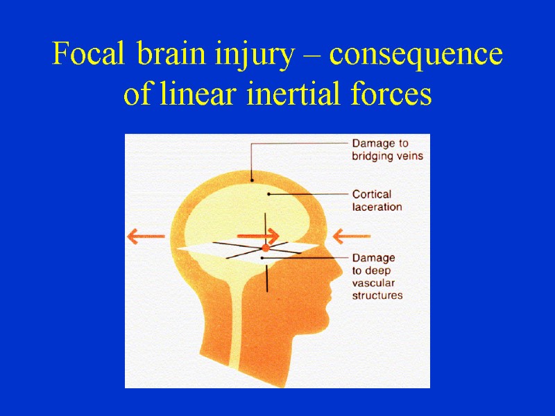 Focal brain injury – consequence of linear inertial forces